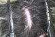 После визита к парикмахеру-садисту московскому школьнику потребовалась пересадка волос
